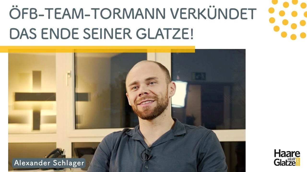 #ichhabsgemacht: Star-Tormann Alexander Schlager hatte eine Haartransplantation
