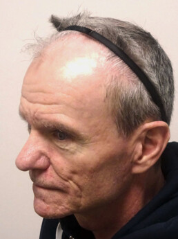 Herr U.J.  vor der Behandlung