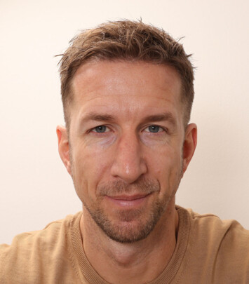 Marc Janko nach der Behandlung