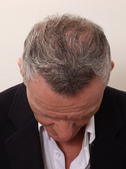 Herr U.J.  nach der Behandlung