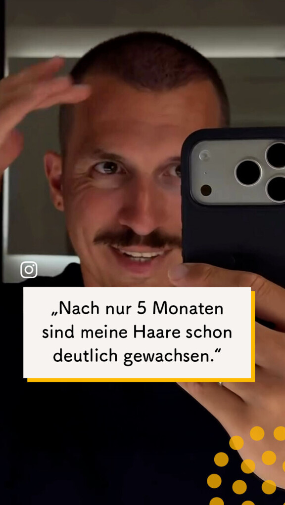 Nach 5 Monaten ist der Unterschied deutlich erkennbar