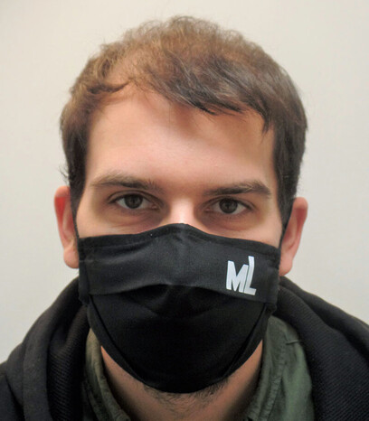 Michael vor seiner 1. Haartransplantation