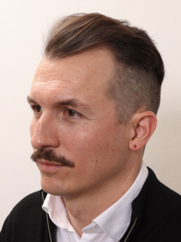 Rene Pranz vor der Behandlung