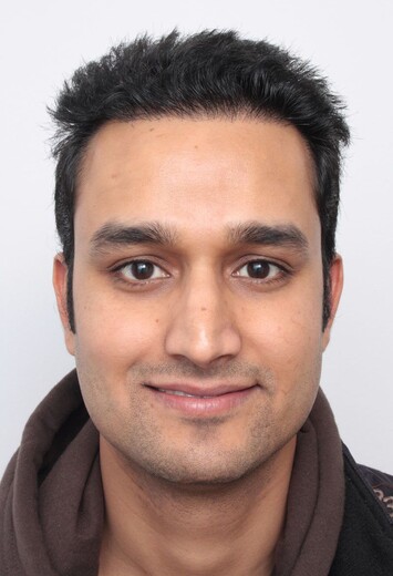 Patient Rohit Singh präsentiert das Ergebnis seiner Haartransplantation bei Moser Medical
