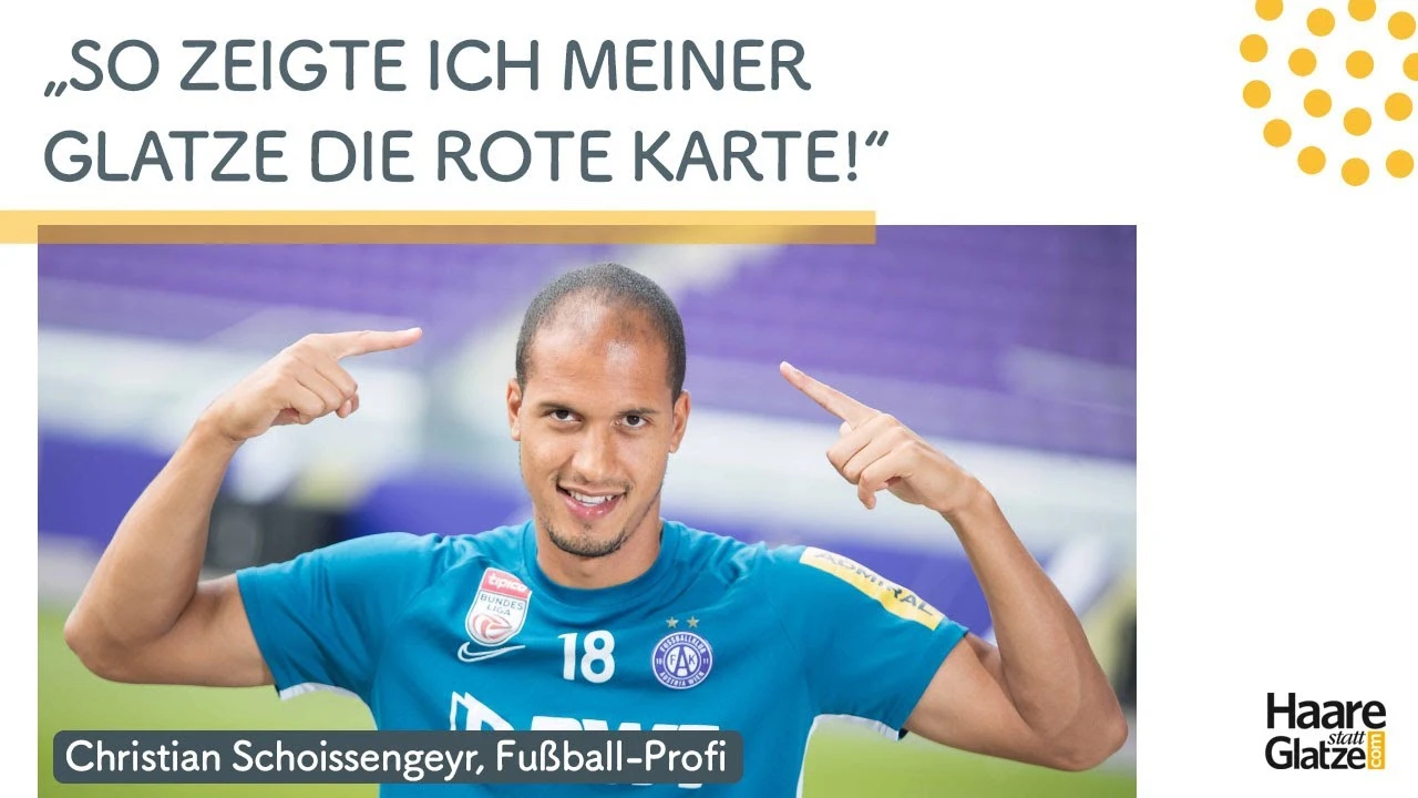 Dieser Austria Wien Fussball-Profi hat sich Haare transplantieren lassen