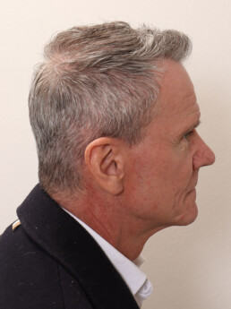 Herr U.J.  nach der Behandlung