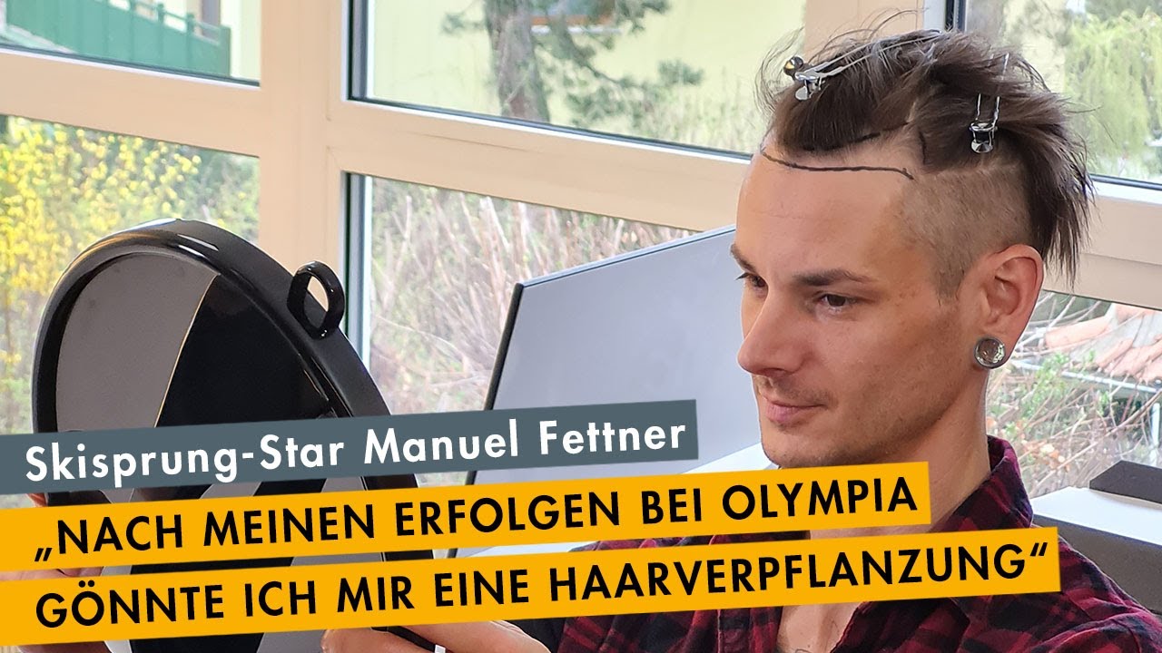 Haartransplantation von Manuel Fettner - der Skisprung-Olympiasiegers war bei Moser Medical in Wien