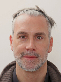 Stefan Maierhofer vor der Behandlung