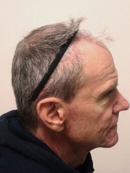 Herr U.J.  vor der Behandlung