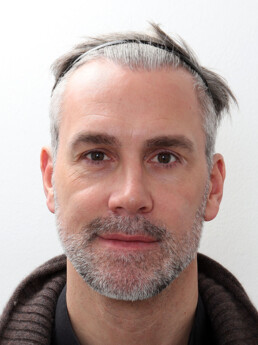 Stefan Maierhofer vor der Behandlung
