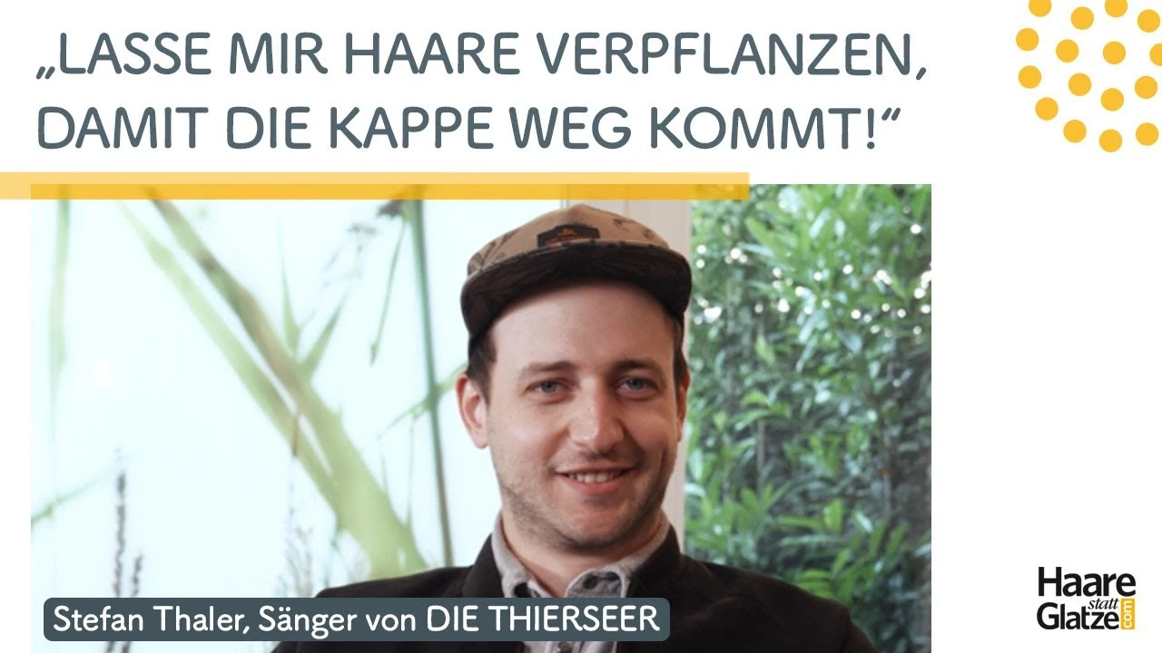 #ichhabsgemacht: Stefan Thaler, Bandmitglied von DIE TIERSEER, ließ sich Haare verpflanzen