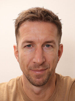 Marc Janko nach der Behandlung