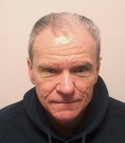 Herr U.J.  vor der Behandlung