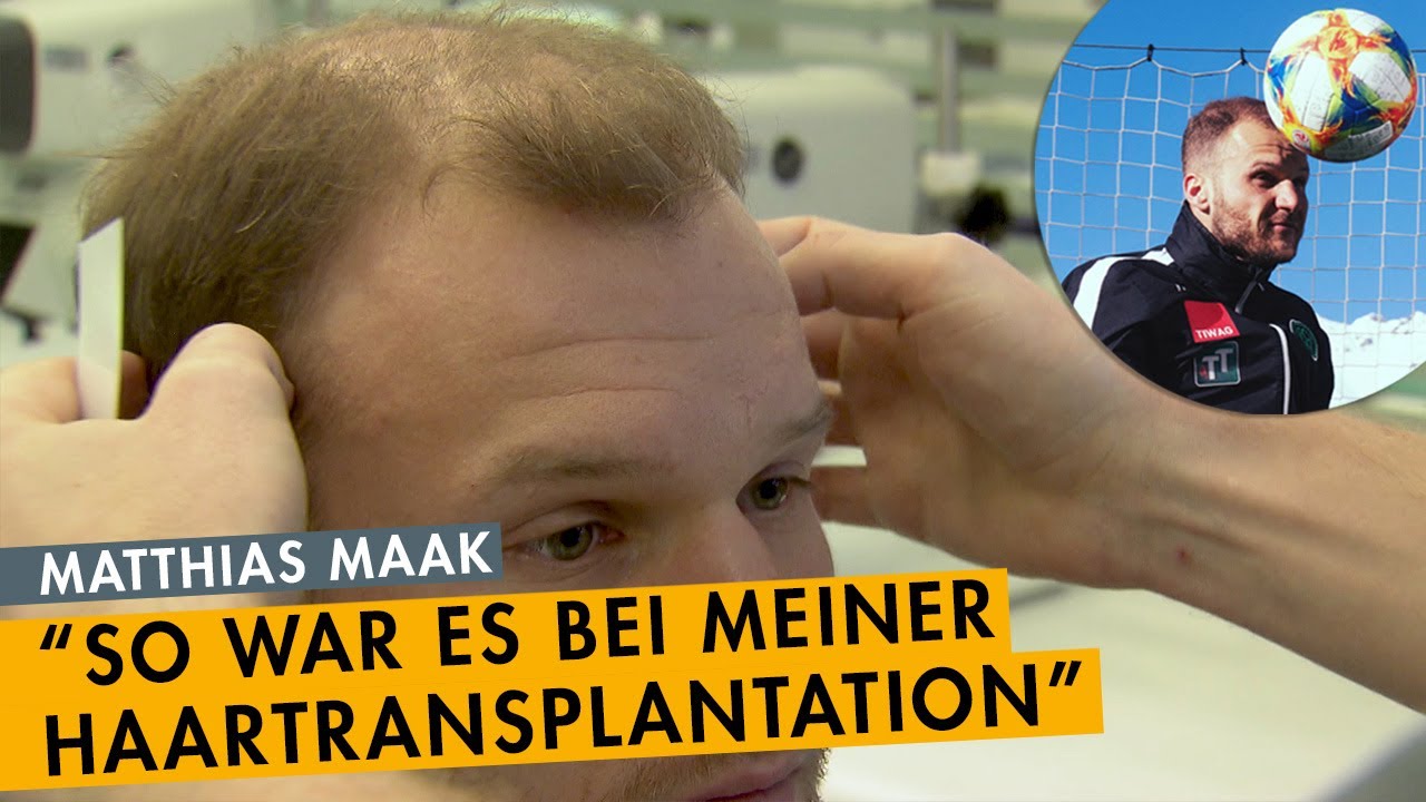 Matthias Maak - das Behandlungsvideo - Fussballprofi mit Haartransplantation