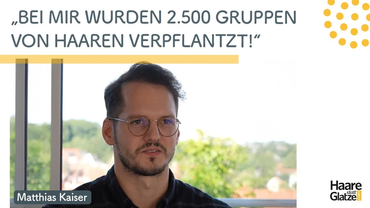 FUE Haatransplantation bei Moser Medical | Hr. Kaiser stellt sein Ergebnis  vor