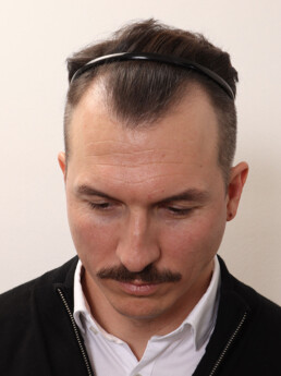 Rene Pranz vor der Behandlung