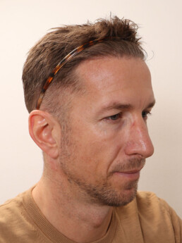 Marc Janko nach der Behandlung