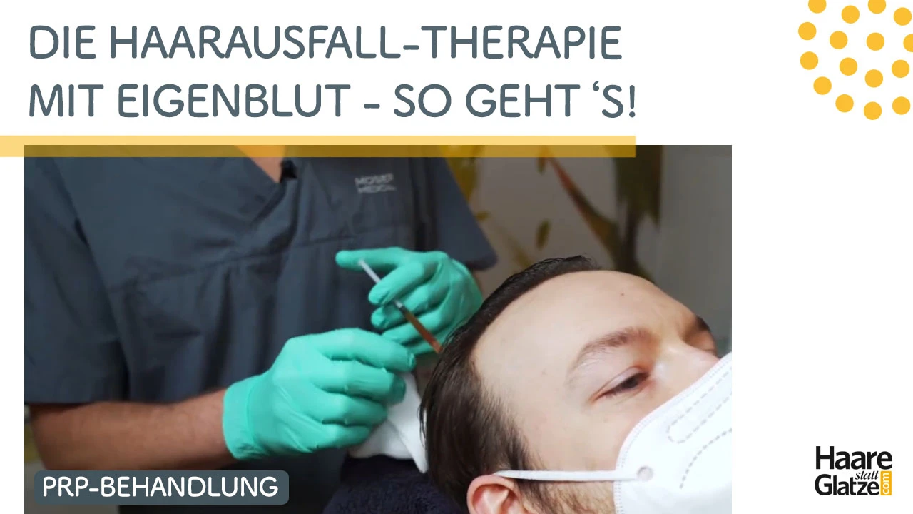 Haarausfall-Therapie mit Eigenblut - so erfolgt die Behandlung gegen Haarausfall | Moser Medical