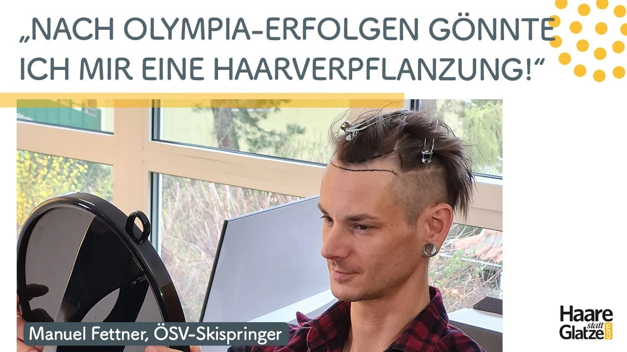 Haartransplantation von Manuel Fettner - der Skisprung-Olympiasiegers war bei Moser Medical in Wien