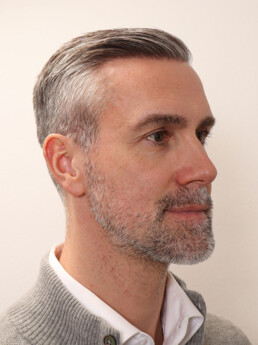 Stefan Maierhofer nach der Behandlung