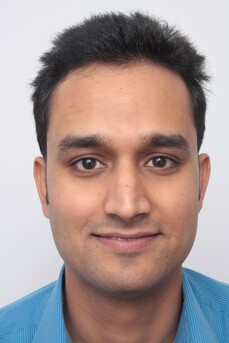 Patient Rohit Singh zeigt seinen zurückweichenden Haaransatz vor einer Haartransplantation bei Moser Medical