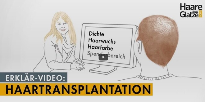 Haartransplantation in 3 Minuten