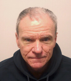 Herr U.J.  vor der Behandlung