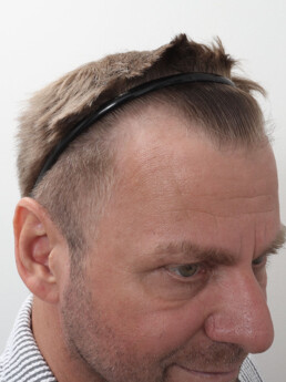 Viorel vor der Behandlung