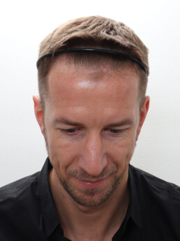 Marc Janko vor der Behandlung