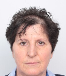 Patientin Renate Prenneis zeigt ihren lichten Haaransatz vor einer Haartransplantation bei Moser Medical