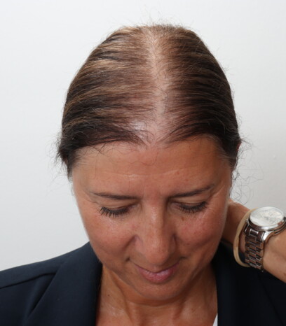 Katja Wachter vor der Behandlung