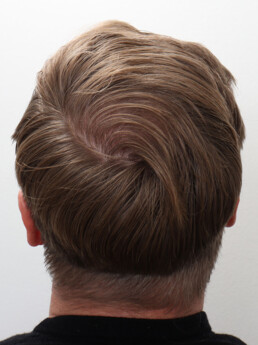 Viorel nach der Behandlung