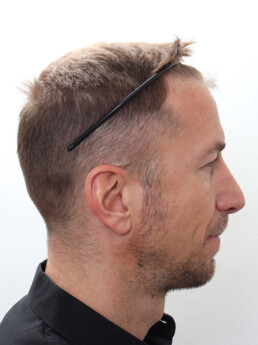 Marc Janko vor der Behandlung