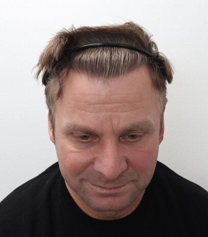 Viorel nach der Behandlung