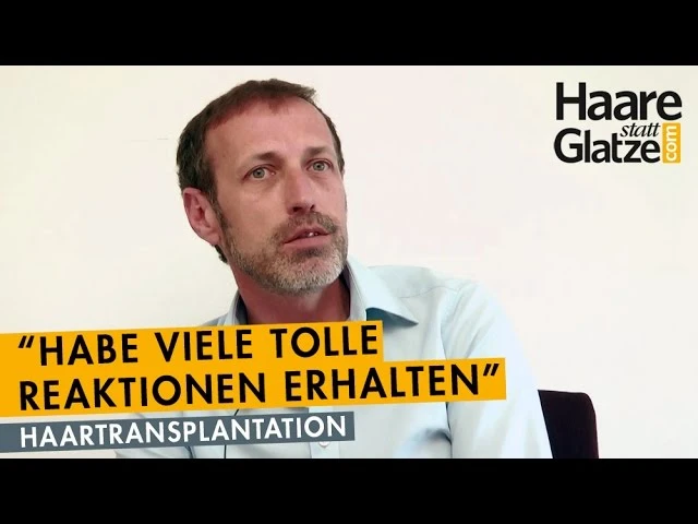 Hoher Haaransatz: Haartransplantation löste das Problem