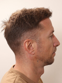 Marc Janko nach der Behandlung