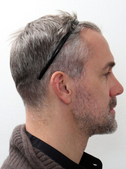 Stefan Maierhofer vor der Behandlung