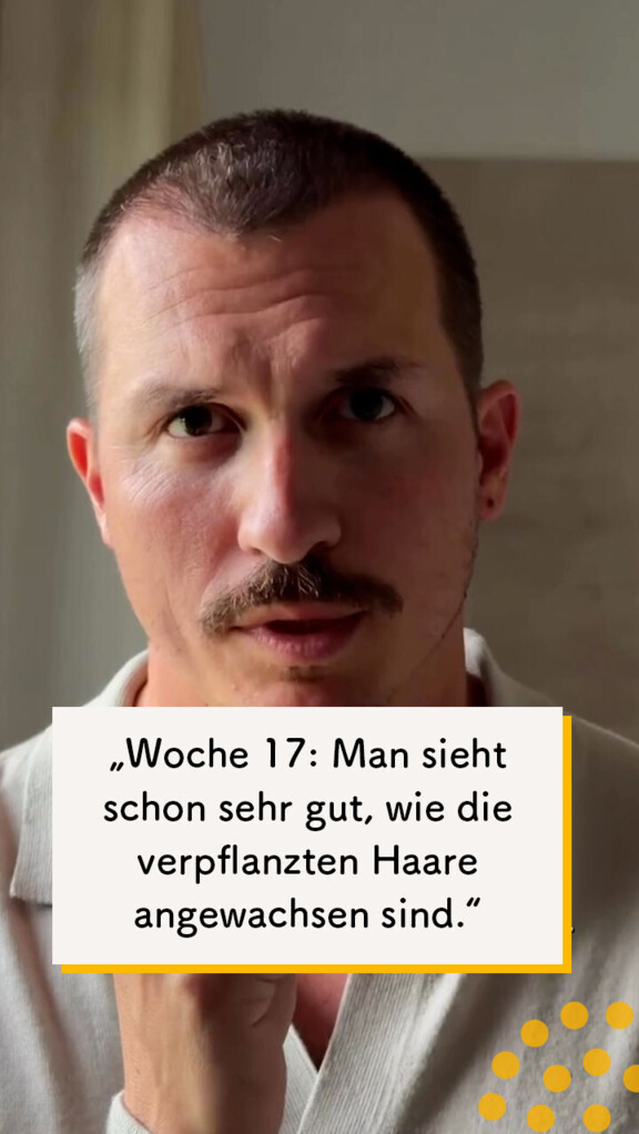 Gutes Haarwachstum in Woche 17