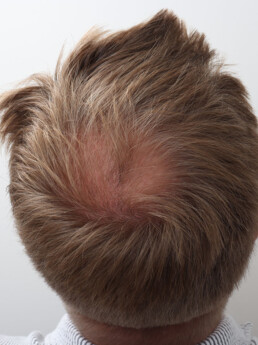 Viorel vor der Behandlung