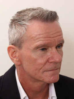 Herr U.J.  nach der Behandlung