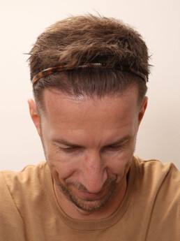 Marc Janko nach der Behandlung