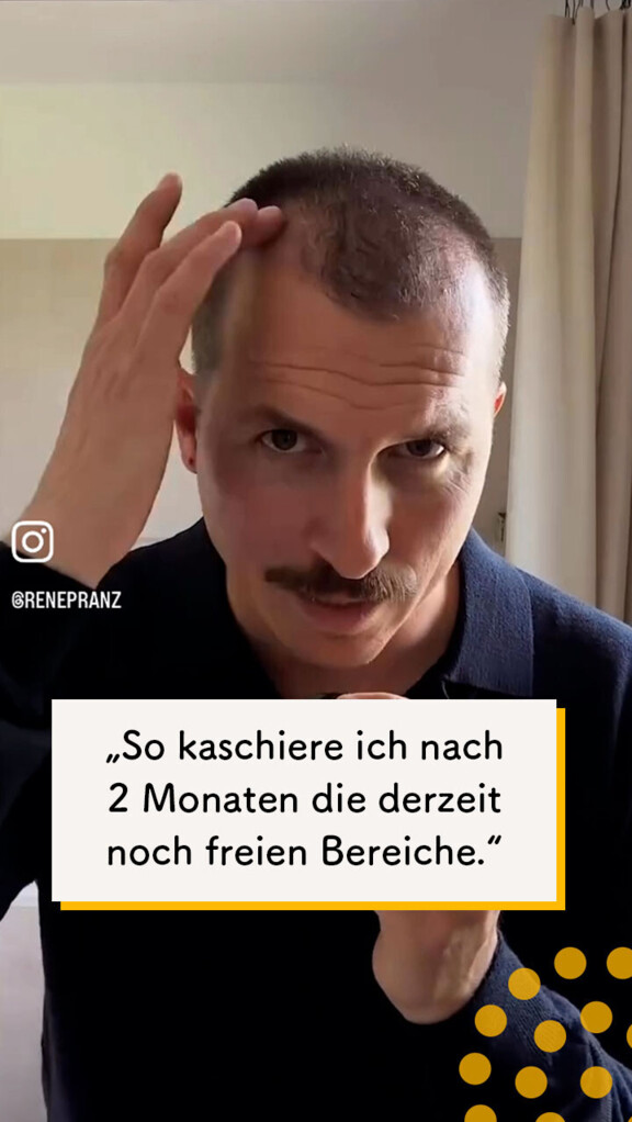 2 Monate nach der Behandlung