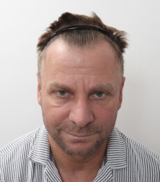 Viorel vor der Behandlung