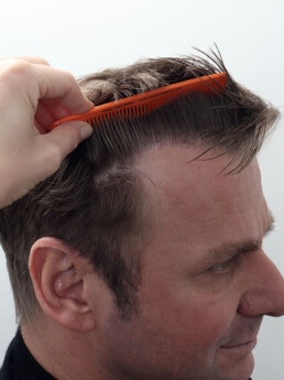 Viorel nach der Behandlung