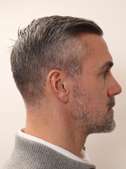 Stefan Maierhofer nach der Behandlung