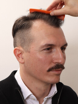 Rene Pranz vor der Behandlung