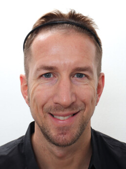 Marc Janko vor der Behandlung