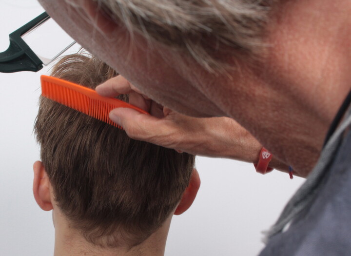 Arzt der Moser Medical Group untersucht die Haarstruktur eines Patienten