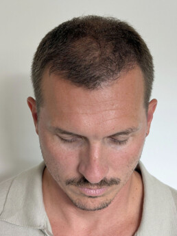 Rene Pranz nach der Behandlung