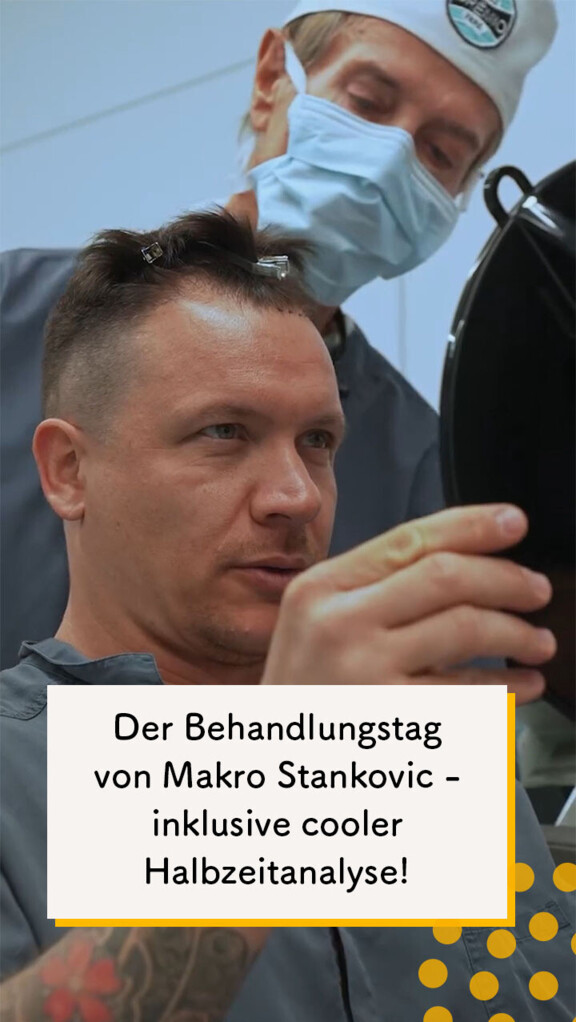 Die Haartransplantation